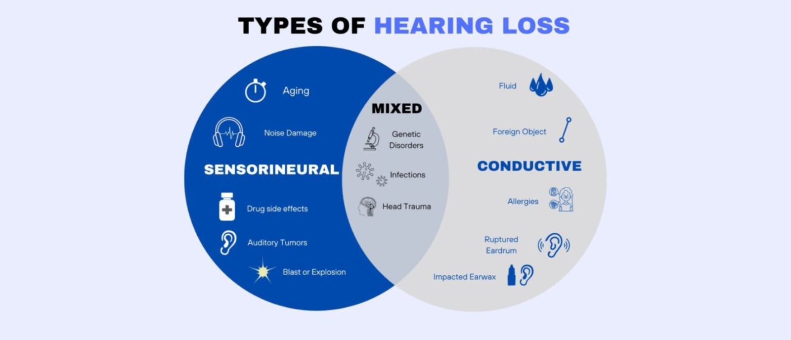 Aanvii Hearing explains how an audiogram shows where hearing loss is happening for accurate diagnosis.